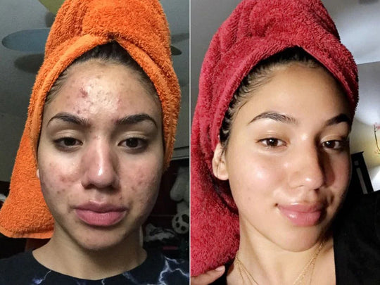Exfoliating Rice Peel Shot