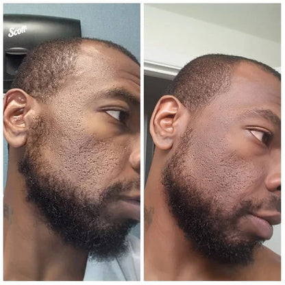 Exfoliating Rice Peel Shot